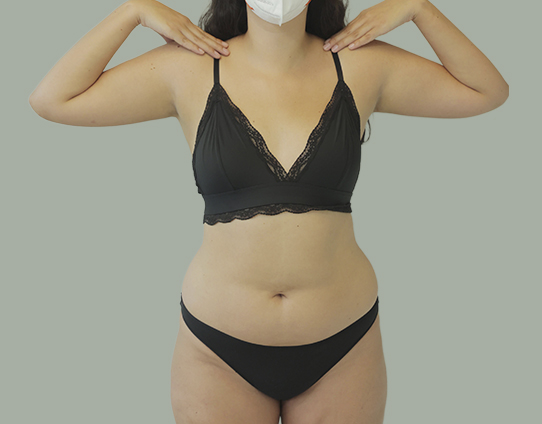 Antes de tratamiento - Mujer